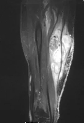 Basic Science 2008 Practice Questions: Set 1 (Solved) - Figure 29