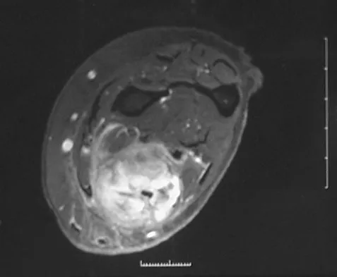 Basic Science 2008 Practice Questions: Set 1 (Solved) - Figure 30