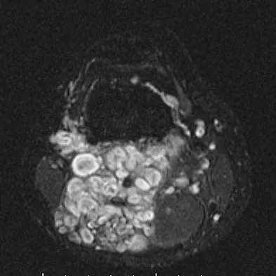 Basic Science 2008 Practice Questions: Set 1 (Solved) - Figure 37