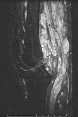 Basic Science 2008 Practice Questions: Set 1 (Solved) - Figure 38