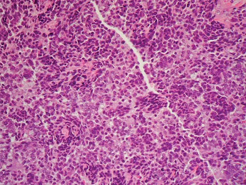 Basic Science 2008 Practice Questions: Set 1 (Solved) - Figure 4