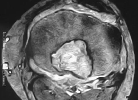 Basic Science 2008 Practice Questions: Set 1 (Solved) - Figure 44