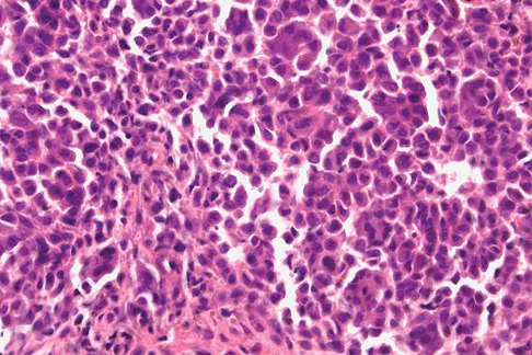 Basic Science 2008 Practice Questions: Set 1 (Solved) - Figure 47