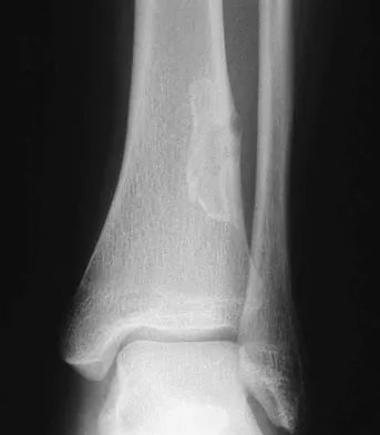 Basic Science 2008 Practice Questions: Set 1 (Solved) - Figure 5