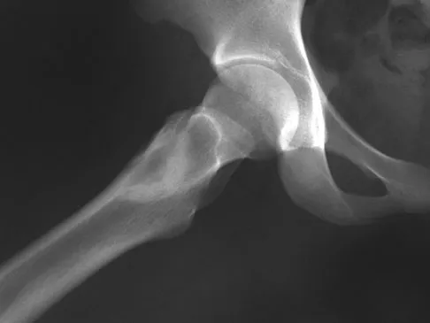 Basic Science 2008 Practice Questions: Set 1 (Solved) - Figure 53