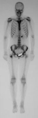 Basic Science 2008 Practice Questions: Set 1 (Solved) - Figure 54