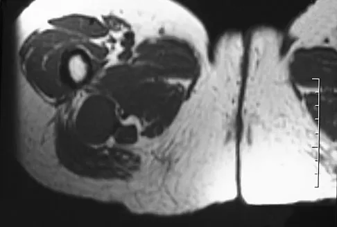 Basic Science 2008 Practice Questions: Set 1 (Solved) - Figure 58