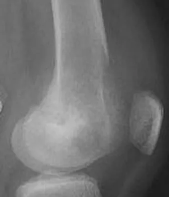 Basic Science 2008 Practice Questions: Set 1 (Solved) - Figure 63