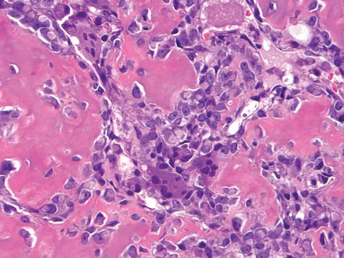 Basic Science 2008 Practice Questions: Set 1 (Solved) - Figure 64