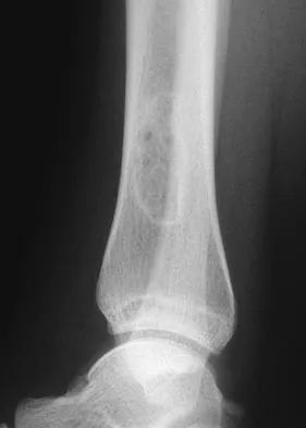 Basic Science 2008 Practice Questions: Set 1 (Solved) - Figure 7