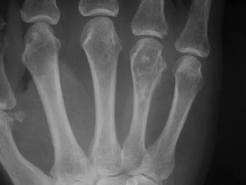 Basic Science Board Review 2008: High-Yield MCQs (Set 2) - Figure 1