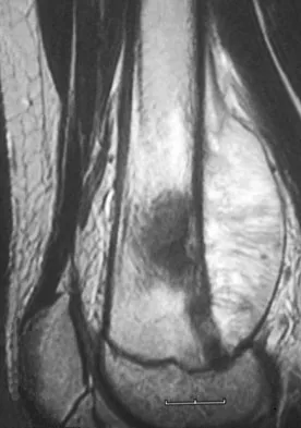 Basic Science Board Review 2008: High-Yield MCQs (Set 2) - Figure 11
