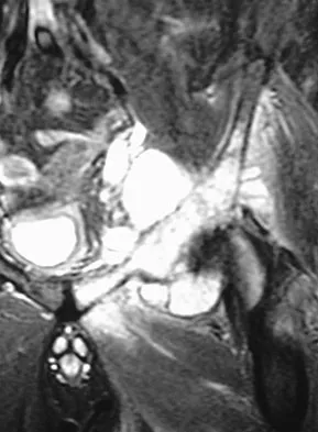 Basic Science Board Review 2008: High-Yield MCQs (Set 2) - Figure 15