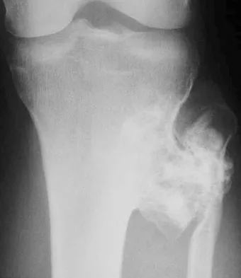 Basic Science Board Review 2008: High-Yield MCQs (Set 2) - Figure 19