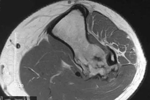 Basic Science Board Review 2008: High-Yield MCQs (Set 2) - Figure 20