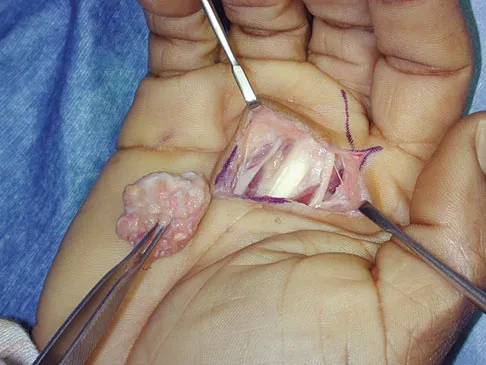 Basic Science Board Review 2008: High-Yield MCQs (Set 2) - Figure 24