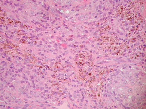 Basic Science Board Review 2008: High-Yield MCQs (Set 2) - Figure 25