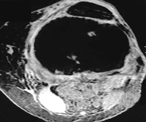 Basic Science Board Review 2008: High-Yield MCQs (Set 2) - Figure 29