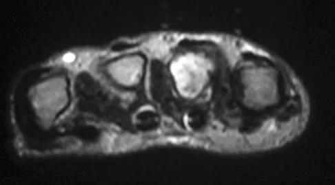 Basic Science Board Review 2008: High-Yield MCQs (Set 2) - Figure 3