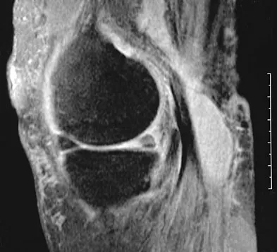 Basic Science Board Review 2008: High-Yield MCQs (Set 2) - Figure 30