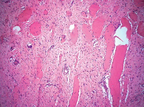Basic Science Board Review 2008: High-Yield MCQs (Set 2) - Figure 33