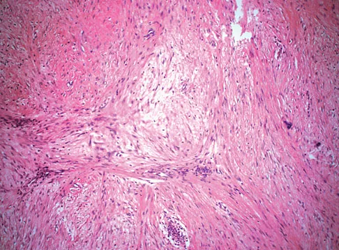 Basic Science Board Review 2008: High-Yield MCQs (Set 2) - Figure 34