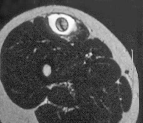 Basic Science Board Review 2008: High-Yield MCQs (Set 2) - Figure 36