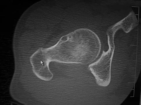 Basic Science Board Review 2008: High-Yield MCQs (Set 2) - Figure 38