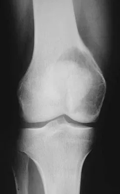 Basic Science Board Review 2008: High-Yield MCQs (Set 2) - Figure 39