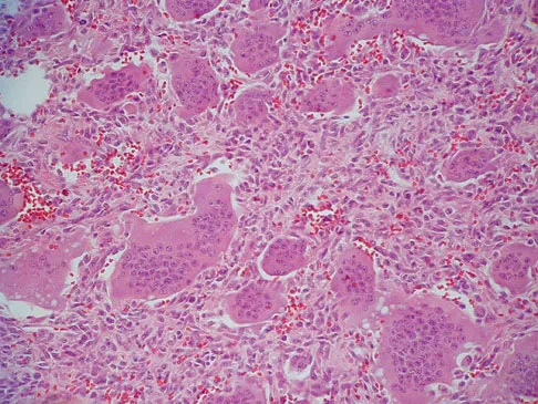 Basic Science Board Review 2008: High-Yield MCQs (Set 2) - Figure 42