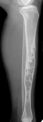 Basic Science Board Review 2008: High-Yield MCQs (Set 2) - Figure 44