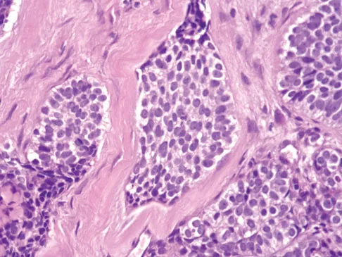 Basic Science Board Review 2008: High-Yield MCQs (Set 2) - Figure 45