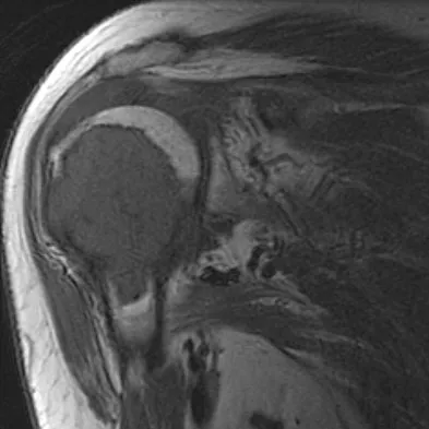 Basic Science Board Review 2008: High-Yield MCQs (Set 2) - Figure 48