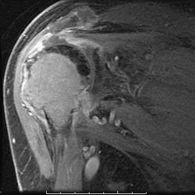 Basic Science Board Review 2008: High-Yield MCQs (Set 2) - Figure 49
