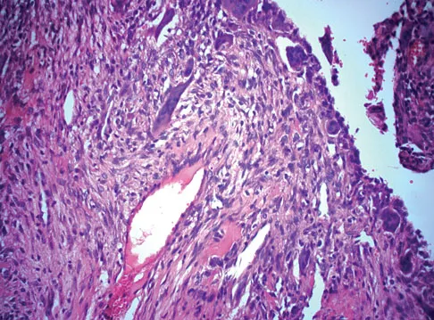 Basic Science Board Review 2008: High-Yield MCQs (Set 2) - Figure 54