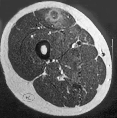 Basic Science Board Review 2008: High-Yield MCQs (Set 2) - Figure 57