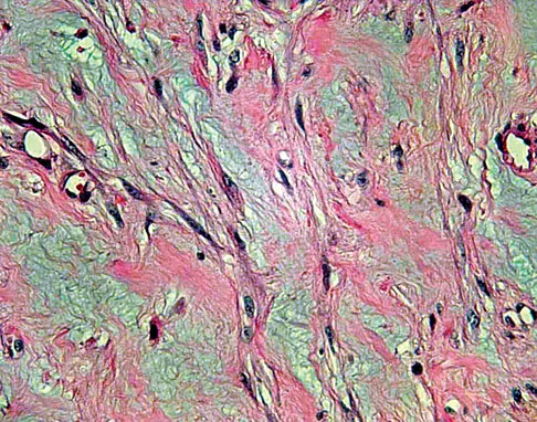Click to enlarge Basic Science Board Review 2008: High-Yield MCQs (Set 2) - Figure 61