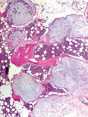 Basic Science Board Review 2008: High-Yield MCQs (Set 2) - Figure 63