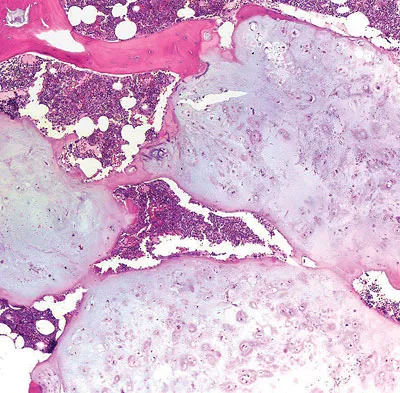 Basic Science Board Review 2008: High-Yield MCQs (Set 2) - Figure 64