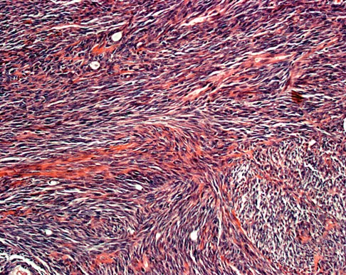 Basic Science 2008 Practice Questions: Set 3 (Solved) - Figure 10