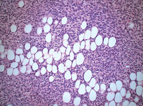 Basic Science 2008 Practice Questions: Set 3 (Solved) - Figure 12