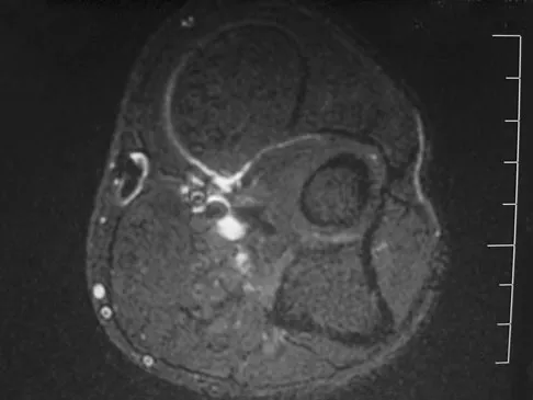 Basic Science 2008 Practice Questions: Set 3 (Solved) - Figure 15
