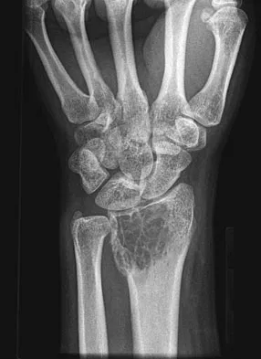 Basic Science 2008 Practice Questions: Set 3 (Solved) - Figure 16