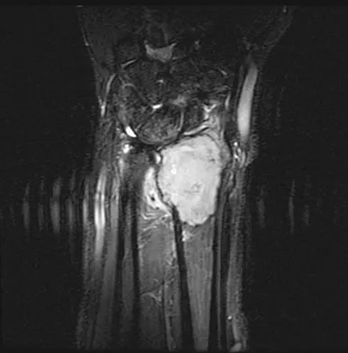 Basic Science 2008 Practice Questions: Set 3 (Solved) - Figure 18