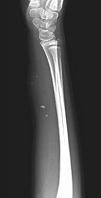 Basic Science 2008 Practice Questions: Set 3 (Solved) - Figure 2