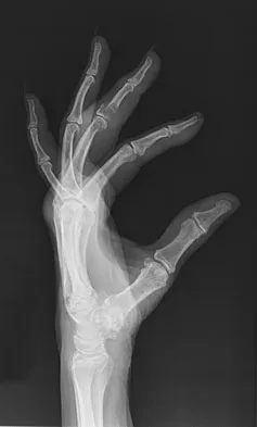 Basic Science 2008 Practice Questions: Set 3 (Solved) - Figure 29