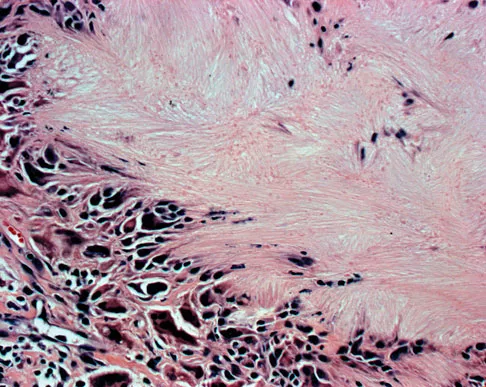 Basic Science 2008 Practice Questions: Set 3 (Solved) - Figure 30