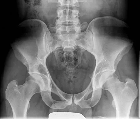 Basic Science 2008 Practice Questions: Set 3 (Solved) - Figure 31