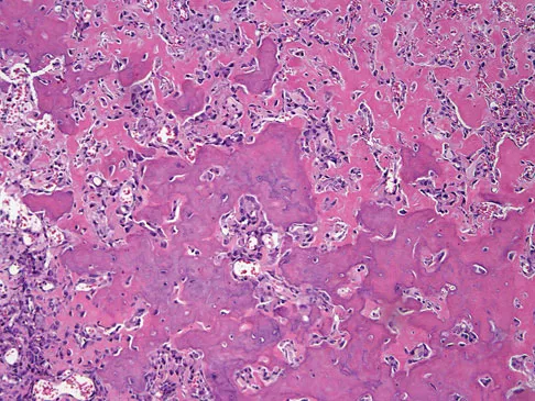 Basic Science 2008 Practice Questions: Set 3 (Solved) - Figure 39