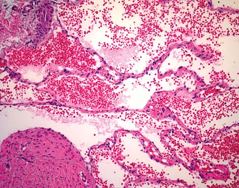 Basic Science 2008 Practice Questions: Set 3 (Solved) - Figure 4